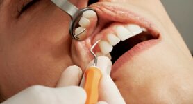 Cette semaine, l'UCR a ouvert l'admission des patients souhaitant recevoir des soins dentaires. Elle se déroulera du lundi 22 au dimanche 26 janvier.