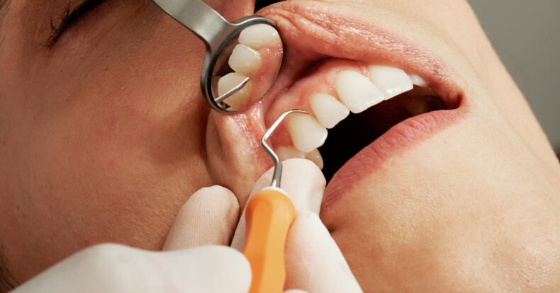 Esta semana, la UCR abrió la admisión de pacientes que deseen recibir algún tratamiento dental. Será del lunes 22 al domingo 26 de enero.